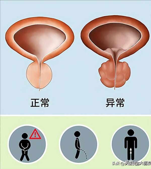 白花蛇草（白花蛇草水）
