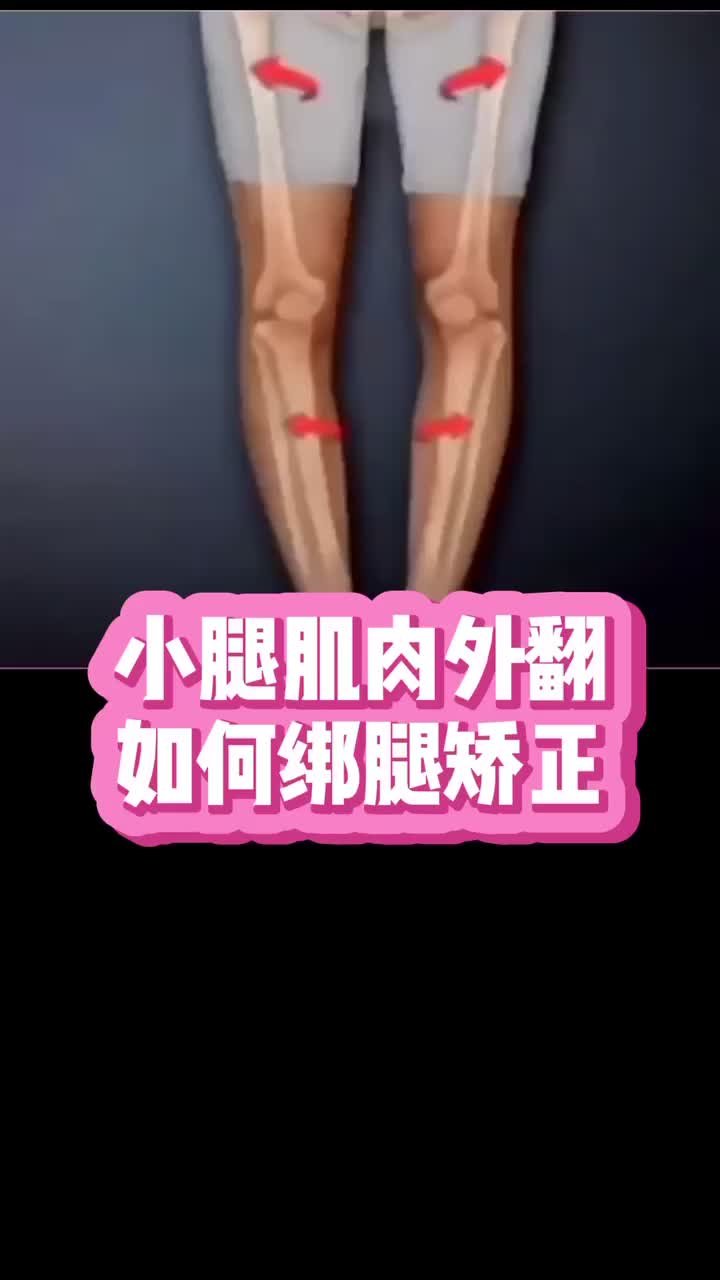 小腿肚外翻 #腿型矫正