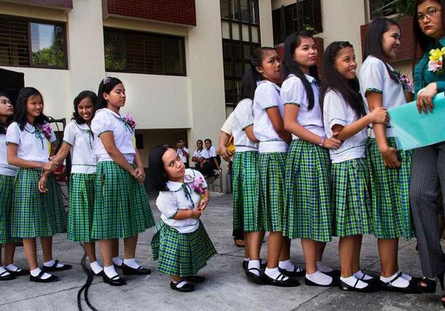 侏儒症患者图片