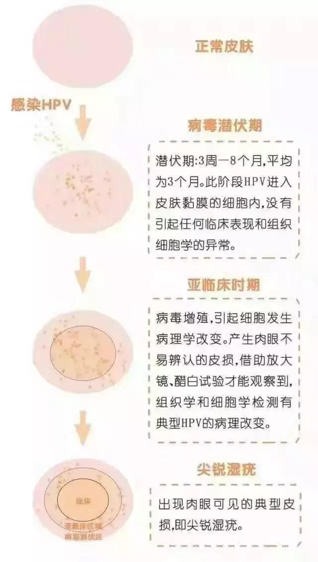 尖锐湿疣严重吗？不治疗会怎样？