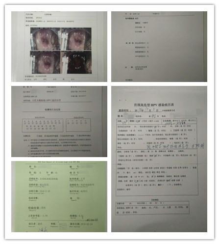 针对高危HPV病毒，单纯用药时间不可过长