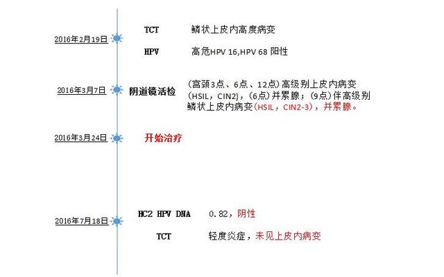 年轻的宫颈CIN患者