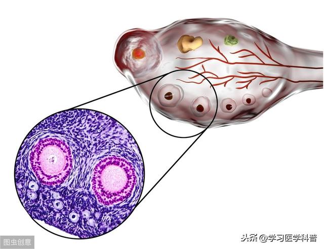 黄体是什么意思黄体囊肿是什么