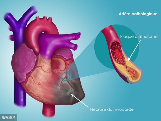 心血管病人吸烟，等同于“追逐死亡”，吸烟为何会加重心血管病？