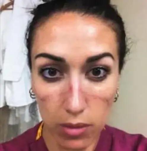 加拿大女医生响应特朗普号召支援美国疫情，结局亮了