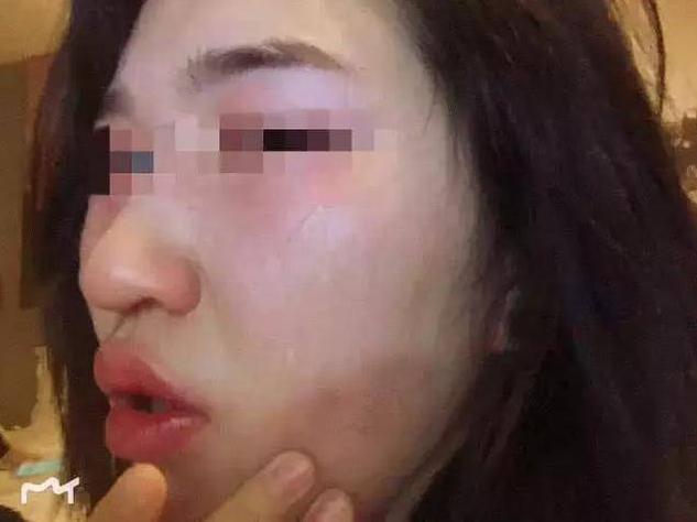 知名女演员自曝被强暴全过程，甚至事后还说觉