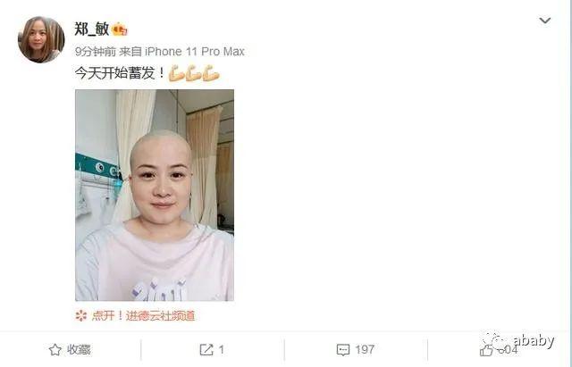 岳云鹏老婆生病住院头发掉光，粉丝捏把汗很担