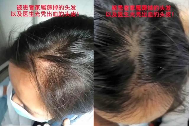 疫情快过去了，有人开始“殴打医生”了！