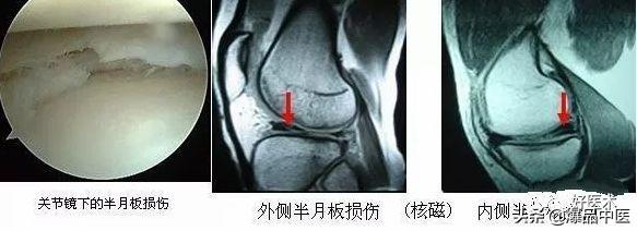 骨科鉴别诊断最全总结，赶紧收藏备用