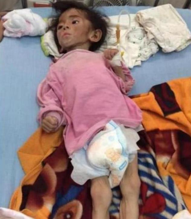 24岁网红收养“皮包骨”女孩，当初被质疑炒作，如今怎么样了