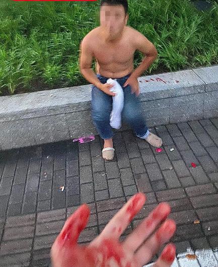 Ҋxֱֹҧֻ_Bg(sh)º(jin)Qڣ