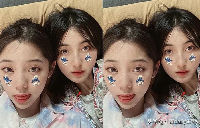 娜娜爆出与张子枫合照，看到妹妹的“脖子”后，网友：太可怕了