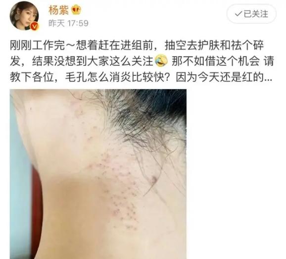 被嘲脸部僵硬，各种活动路透图虎背熊腰，杨紫：我用演技说话