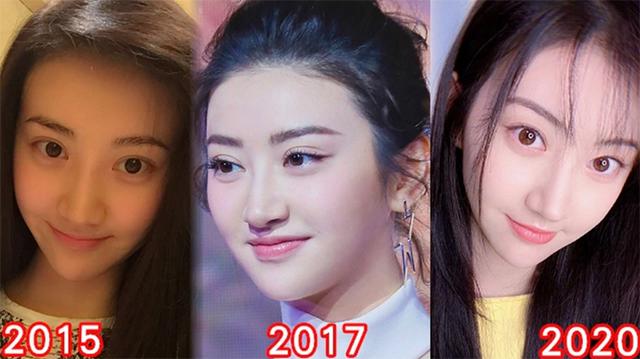 32岁景甜开直播大方承认整容，坦言抑郁了很久，每天都懊悔想哭