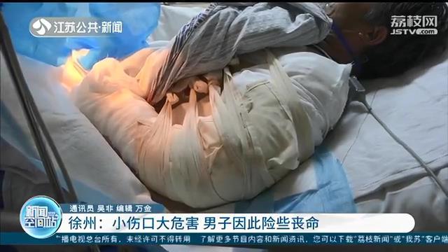 小伤口没往心里去，男子因此险些丧命 输了3000毫升血才救了回来