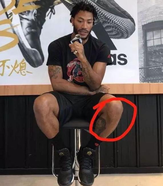 NBA球星的傷疤：羅斯的膝蓋 科比的跟腱 詹姆斯的頭部