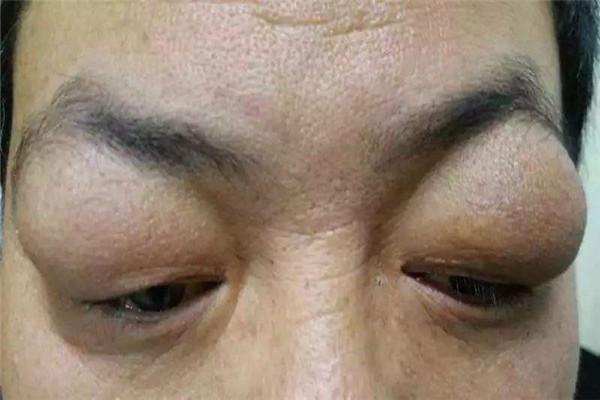 甲状腺出现问题，这些症状最明显，你不来看看么？