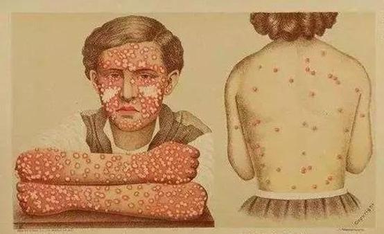 新冠病毒肆虐，日本为何佛系防疫