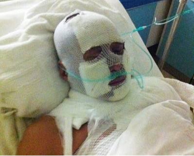 爆红歌星陈少华：被粉丝一刀砍掉下巴，断送事业，居然选择原谅？