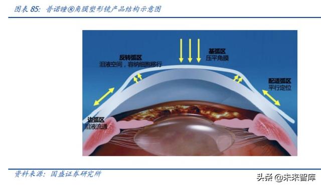 爱博医疗深度解析：专注创新的眼科器械龙头企业