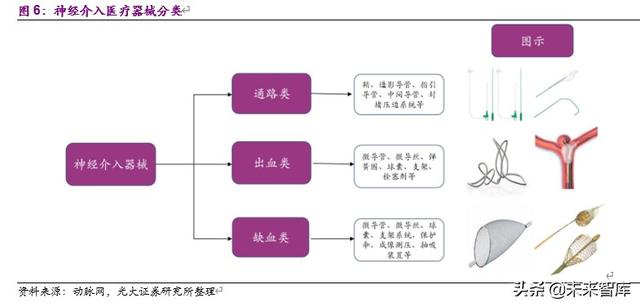 神经介入行业深度报告：介入手术皇冠上的明珠，百亿蓝海即将起航