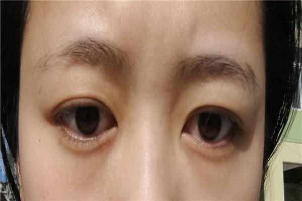 甲状腺出现问题，这些症状最明显，你不来看看么？