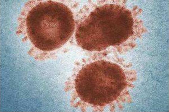 全球确诊突破482万，如今各国当务之急是什么？