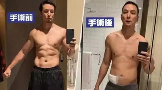 吴彦祖自曝因这个险丧命：在健康面前，每个人都是弱者 。
