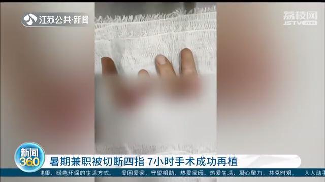 大学生暑期兼职被切断四指 7小时手术成功再植
