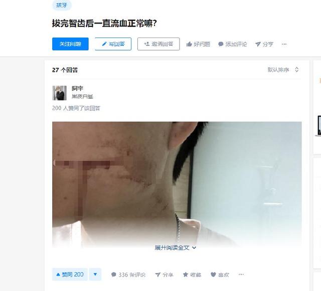 26歲小伙拔智齒出血不止10天后死亡，醫(yī)生稱血液里全是細(xì)菌