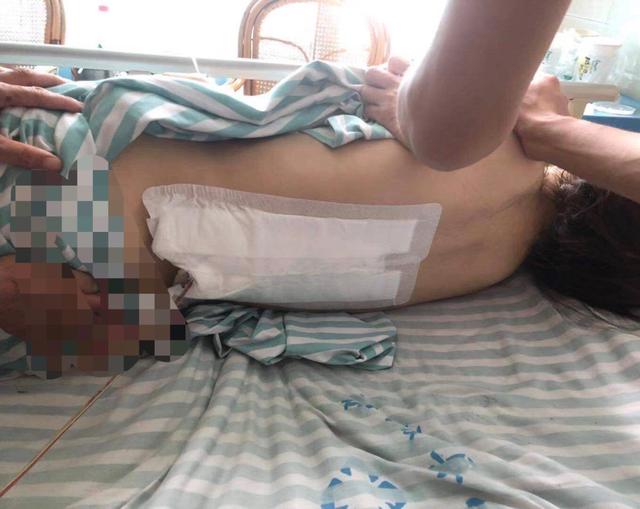 跳楼|女子不堪家暴跳楼双下肢截瘫 商丘市妇联介入