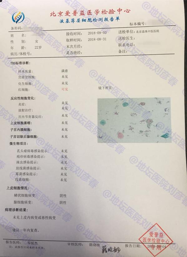 宫颈癌筛查中的TCT报告提示炎症是怎么回事？是否需要治疗？