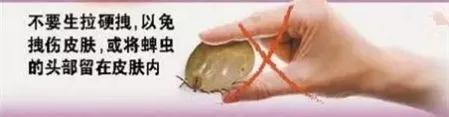 抚州人注意！近期高发！严重可致命