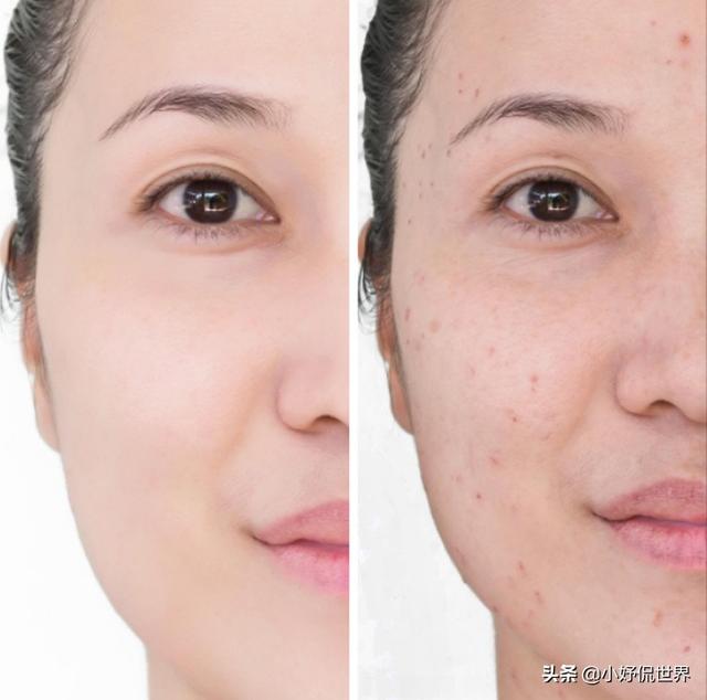 化妆湿巾对皮肤可能起到的6个破坏作用
