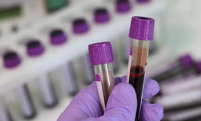 美帝弃疗，首席专家福奇：为保经济，死亡人数