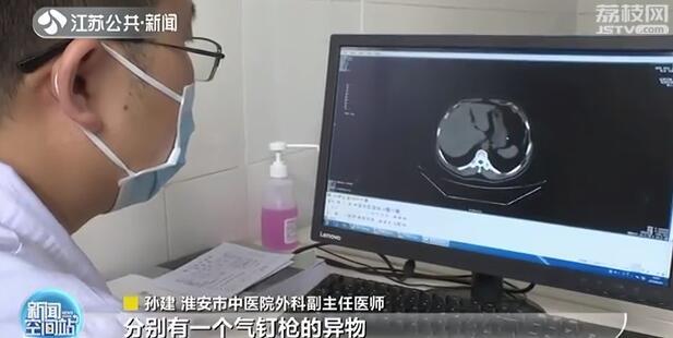 气钉枪突然“走火”两颗钉子射入男子体内