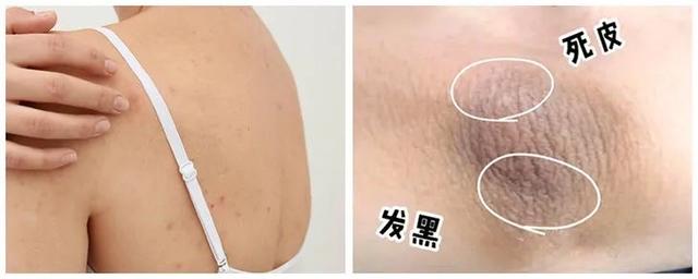 洗澡还在用手搓？死皮泥垢洗不掉，30年的澡都白洗了