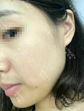 唯诺雅告诉大家：女性30+也会开始面临一个不可忽视的现象