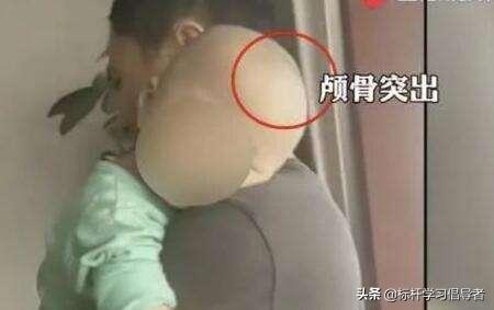 “大头娃娃”阴霾12年不散，别让三聚氰胺的噩梦卷土重来