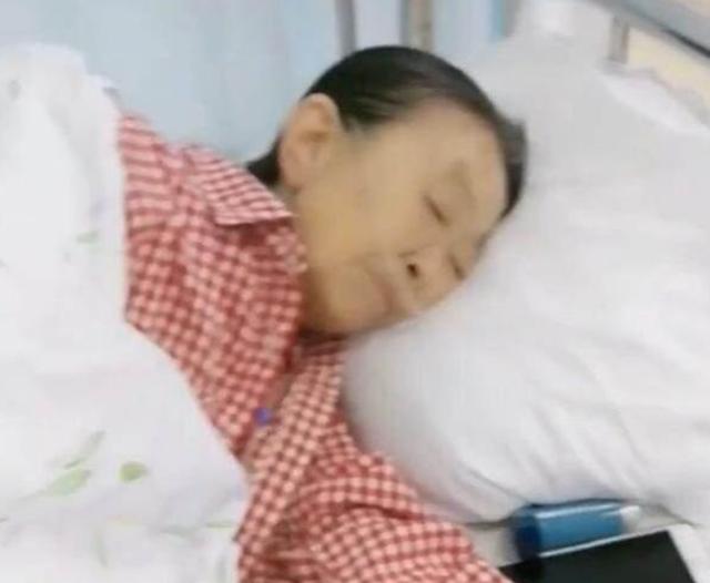 83岁"丑娘"张少华晚年凄惨？插呼吸机独自住院，瘦骨嶙峋无人管
