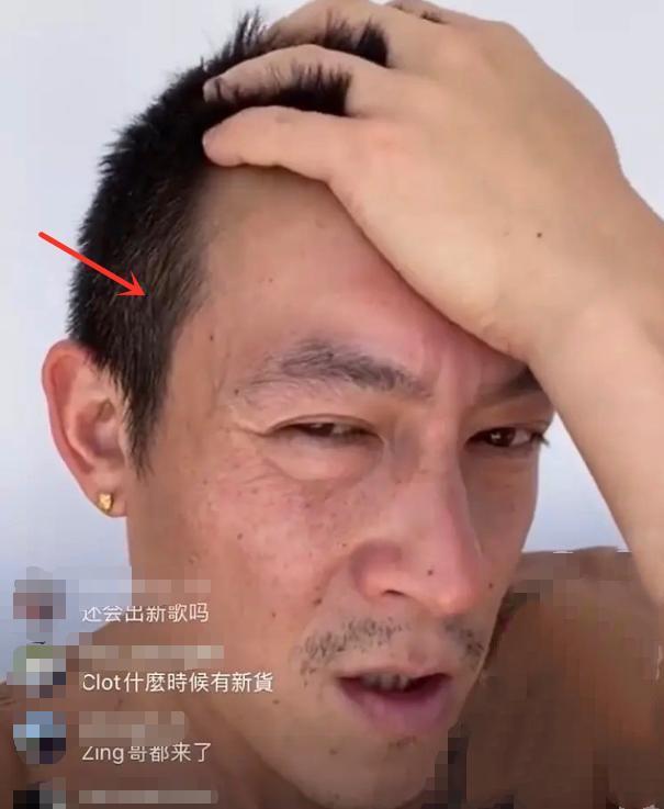 陈冠希也有这么一天？满脸黑斑不敢认，被称像赵本山都是抬举了