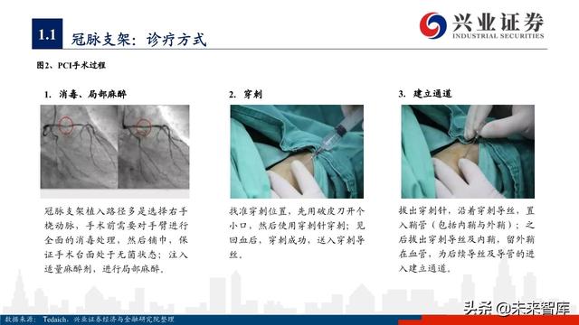 医疗器械之冠脉支架行业深度研究与投资策略