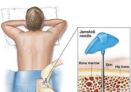 骨髓捐献者与被捐者，为何一年内不许见面原因很现实