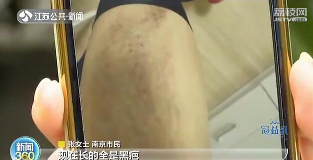 [妊娠纹]南京这家店却跑路了 坑人！花了2万元妊娠纹一点不见少