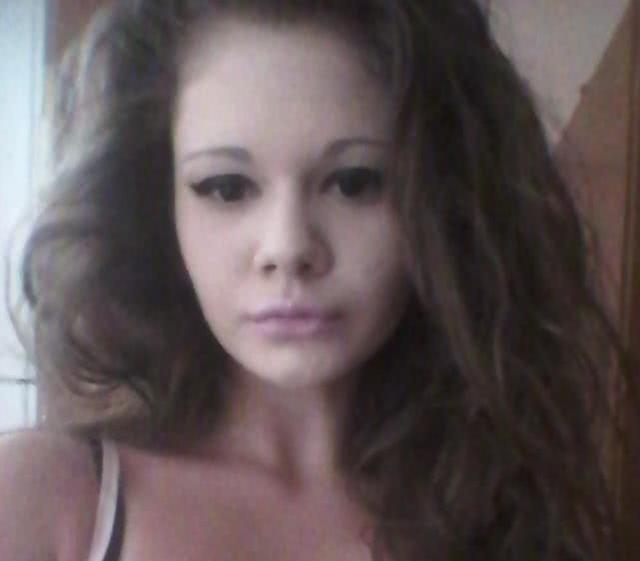 保加利亚一个女子狂爱丰唇，上瘾20次后，悲剧发