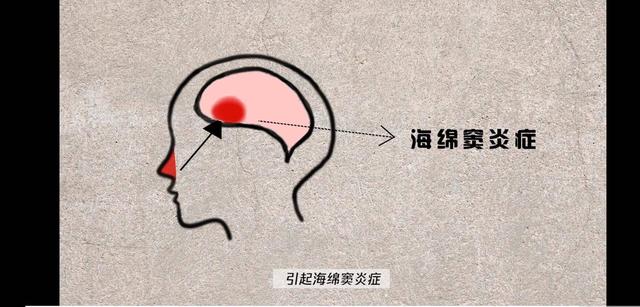 为什么大家都爱抠鼻屎？抠鼻屎会把鼻孔越抠越大吗？