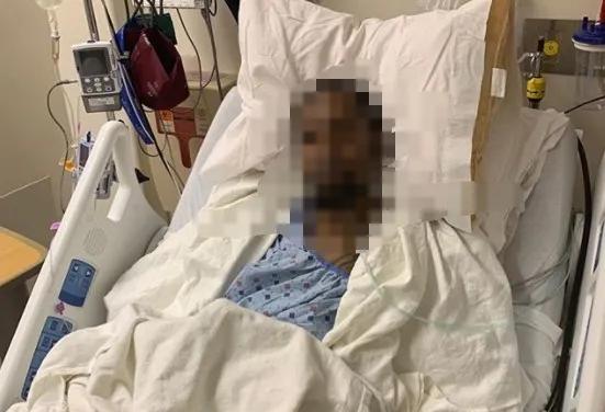 打球导致九级伤残！索赔13万！法院判决14岁少年