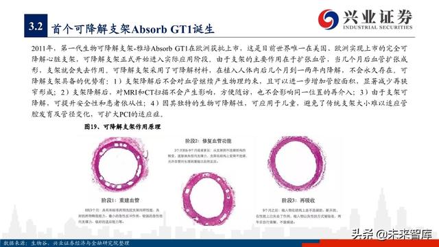 医疗器械之冠脉支架行业深度研究与投资策略