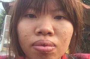 Because Vietnam woman is ugly marry do not go out,