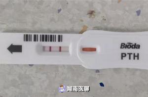 The old lady relapses bellyacke vomits 2 years, helping abdomen up to ask doctor, gram size 